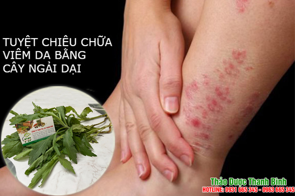 Cây ngải dại Thảo Dược Thanh Bình