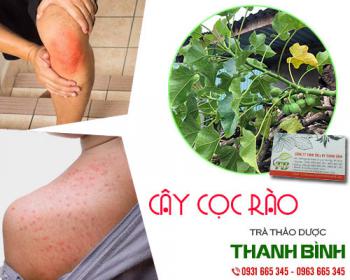 Cách sử dụng cây cọc rào trong điều trị nước ăn chân tay tốt nhất