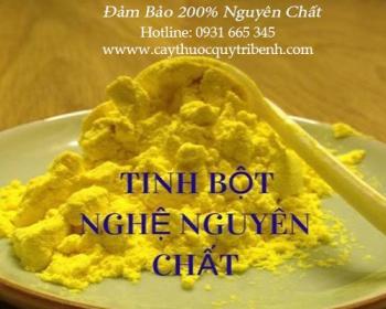Mua bán tinh bột nghệ uy tín tại quảng nam có tác dụng chữa mất trí nhớ